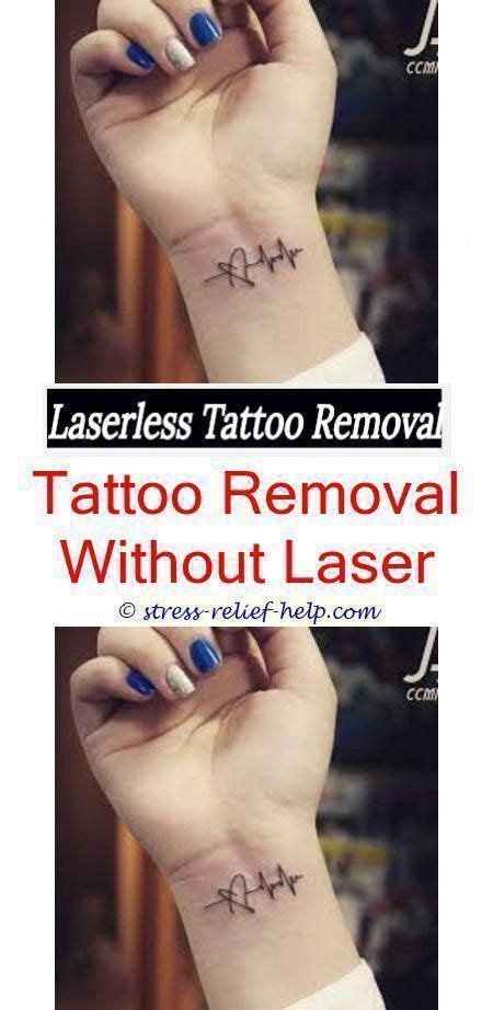 How much the picosure laser costs and how much it hurts. tattoo removal procedure how much is it to have a tattoo ...