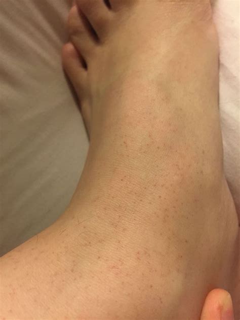 The conditions may be mild such as allergies or serious such as cancer, which requires urgent medical attention. Skin Concern These tiny red dots on the top of my feet ...