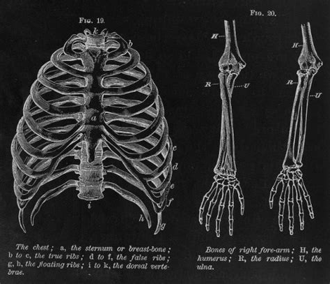 An uneven rib cage means the two sides of the rib cage are not symmetrical. drawing Illustration art artwork bones ribs Anatomy ...