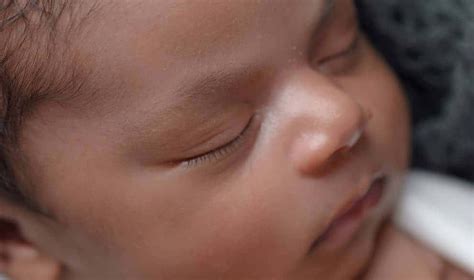 Manchas blancas tras la depilación después del bronceado, la depilación puede dar lugar a la formación de un halo blanco al retirarse la capa lavarse la cara con esta agua la mañana siguiente. CUIDADOS PARA LAS MANCHAS BLANCAS EN LA CARA EN NIÑOS