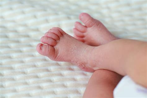 Hingga detik ini belum ditemukan cara ataupun alat yang bisa digunakan untuk mendiaknosa penyebab penyakit ini. Kulit Jari Kaki Kering Dan Gatal - Zafrina