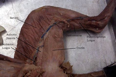 Using quizlet to aid in memorization of the different muscles, organs, structures, arteries, veins, nerves, etc., and writing out all the the cat include. Cat Dissection Study Tools: Muscular System