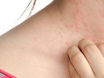 Why do i feel so itchy? Itchy Bumps All Over Body: 5 Possible Causes and ...