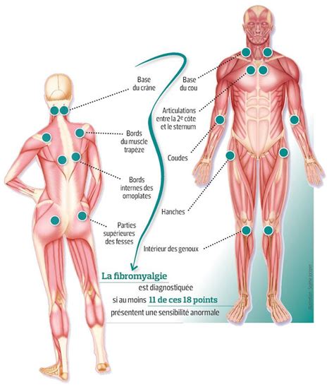 Fibromyalgia is not an autoimmune or inflammation based illness, but research suggests the nervous system is involved. fibromyalgie symptomes: qu'en est-il de la psychothérapie