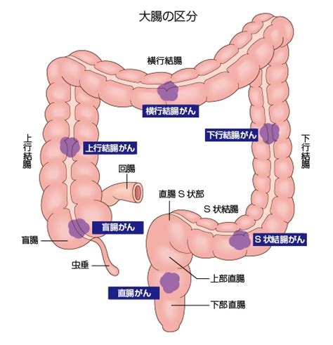 がんゲノム 情報管理センターcenter for cancer genomics and advanced therapeutics. 大腸がん