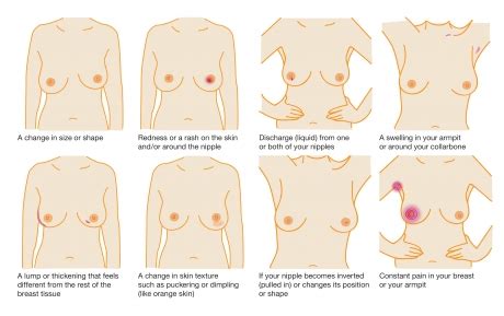 Sometimes they are the first sign of a brain tumor. Overcoming taboos to checking your breasts | Breast Cancer Now