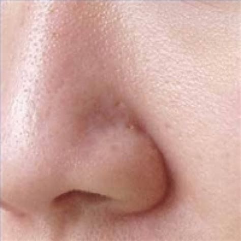 A lot of young and old women face the problem of open pores. How to Naturally Reduce the Visibility of Skin Pores on ...