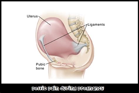 Ketika sudah mendapat perawatan dokter, seseorang akan rutin perawatan untuk sakit kepala di belakang telinga yang akan mencakup mengelola rasa sakit. Tips atasi sakit belakang dan pinggul ketika hamil - Blog ...