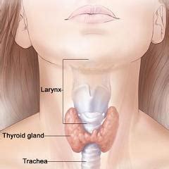 Peut on mourir du cancer de la thyroide. Une tumeur de la thyroïde qui n'est plus considérée comme ...