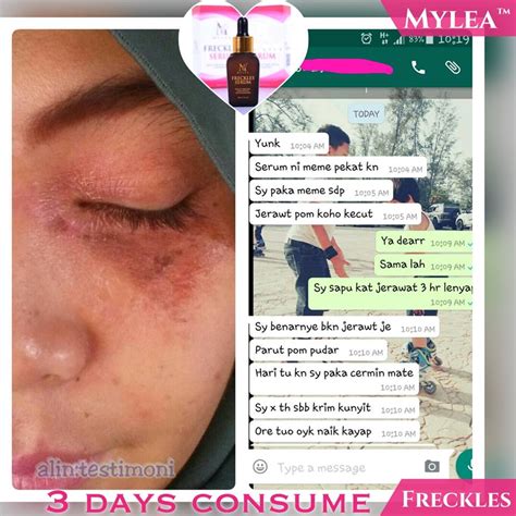 Ole esimene, kes hindab toodet freckles serum tühista vastus. Anna Mika Beauty & Health: MYLEA FRECKLES SERUM