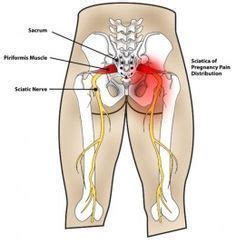 A tight psoas muscle can cause problems in your low back and hip area. Pin on lower back exercises