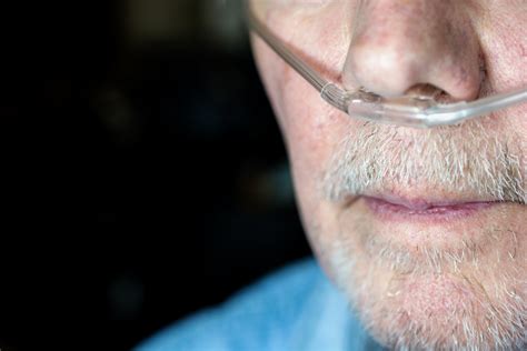 Copd und lungenemphysem sind chronisch obstruktive lungenerkrankungen. Meer klachten bij COPD-patiënten in omgeving van ...