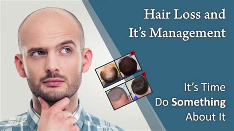 Though no shampoo to date has been fda approved as a hair loss treatment, there is some scientific evidence to suggest that ketoconazole. Hair Loss & Its Management | Best Treatment For Hair Loss ...