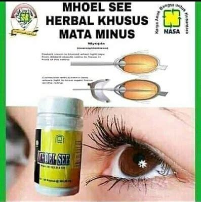Hilangkan Mata Minus Anda Dengan Mhoel See Nasa