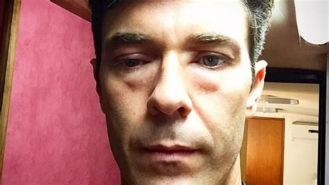 Por un ataque de alergia, Mariano Martínez amaneció con la ...