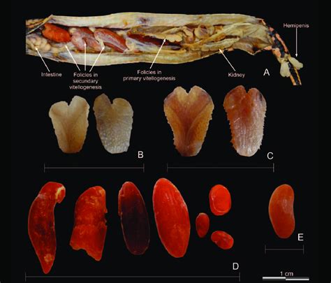 (biology) having both male and female characteristics, or characteristics intermediate between the sexes. (A) General view of reproductive organs of the intersexual specimen of... | Download Scientific ...