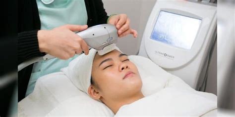 Treatment laser berikutnya adalah laser resurfacing. Serba-Serbi HIFU Treatment untuk Kulit Wajah