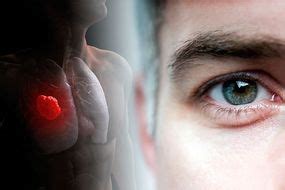 Noticing a pain in these body parts. Lung cancer: If you feel a pain in these body parts it ...