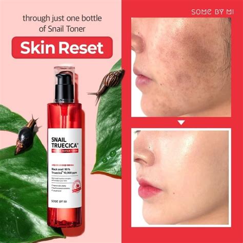 Read on for our first impressions of the toner and complementary four superstar products from the brand, including the aforementioned toner and serum, are finally available on sokoglam.com and we couldn't. Jual SOMEBYMI Snail True Cica Miracle Repair Toner 135ml ...