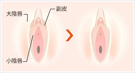 小 陰部 かゆい | 小陰唇が腫れるのはなぜ？｜東京の小陰唇縮小 ...