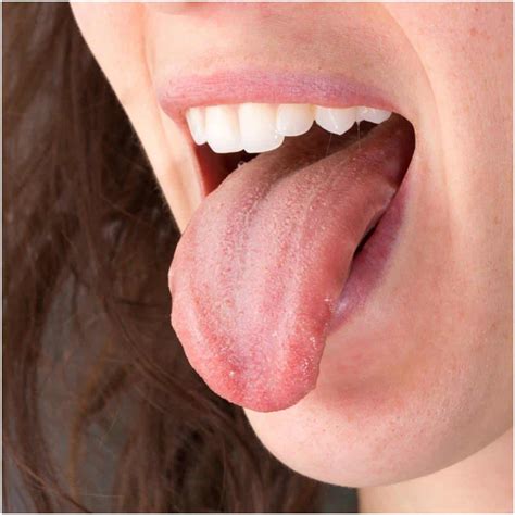 Kidney | Tongue | Spleen - Qi Deficiency: Treatment, Meaning, And Diet ...