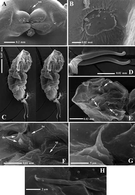 Groin strain treatment rehabilitation exercises although there is often swelling oedema as a result of a groin strain this is often not visible to the eye groin strains are graded 1 2 or 3 depending on the extent of the injury groin muscle diagram diagram muscles in groin area male. Eurysilenium australis sp. nov. Adult female: A, genital area showing... | Download Scientific ...