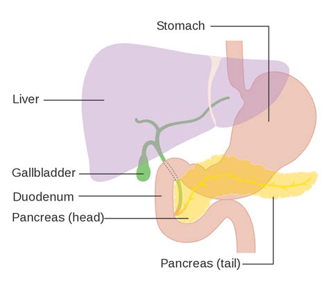 How do i know if i have this? Cancer de pancreas - Pancreatic cancer - qaz.wiki