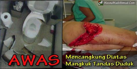 Tetapi sebelum dia duduk di atas permukaan tandas tersebut, dia sempat melihat lubang pada mangkuk tandas itu. lagenda AMARAIZAT: akibat mencangkung di atas mangkuk ...