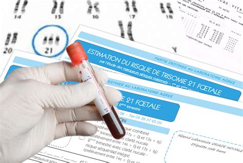 .modalités du dépistage de la trisomie 21 paraissent atteints en grande partie dans la mesure où nous encore être évalués, en particulier la sensibilité actuelle du dépistage de la trisomie 21. Le dépistage prénatal de la trisomie 21 s'intensifie ...