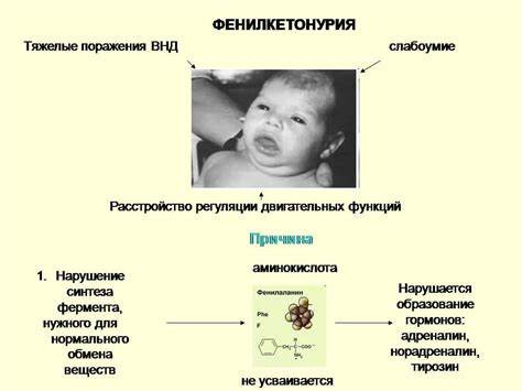Без молочная диета для детей