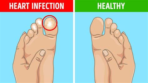 Nausea, mual mutah dan malaise. 6 Kondisi Kaki Ini Menandakan Ada Masalah Kesehatan pada ...