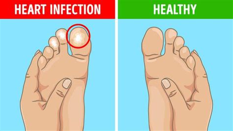 Nausea, mual mutah dan malaise. 6 Kondisi Kaki Ini Menandakan Ada Masalah Kesehatan pada ...