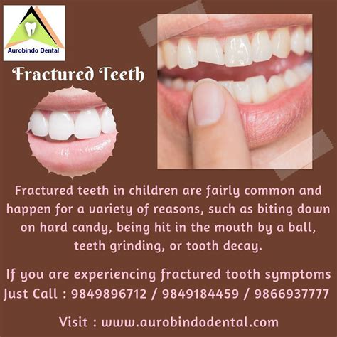 Check spelling or type a new query. Root Canal After Care Straw