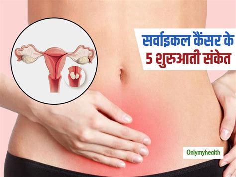 A sign of cervical cancer is pelvic pain, especially continuous pain. Cervical Cancer Or Cervix Cancer Warning Signs For Womens ...