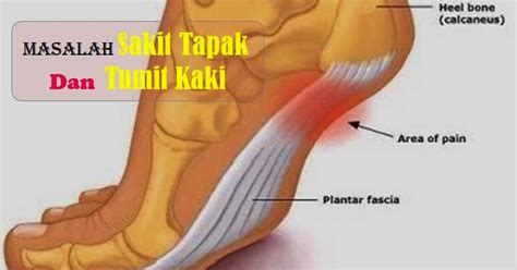 Selain itu, sebaiknya pijat tumit anda yang sakit setelah mandi atau merendam kaki. Masalah Sakit Tapak Dan Tumit Kaki