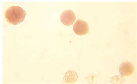 Check spelling or type a new query. Pollen samples stained with acetocarmine. Oversized ...