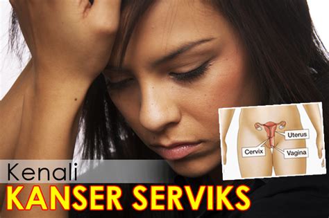 Rahim ağzı organından gelişen kanserlere serviks kanserleri, serviks ca (cervix ca) veya rahim ağzı kanserlerinde tanı nasıl konulur? 7 FAKTOR TERJADINYA KANSER SERVIK - Let's Stay Healthy