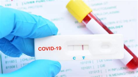 08 set 2020 · notícias 37 comentários. COVID-19: Quer saber se foi infetado? Faça um teste gratuito