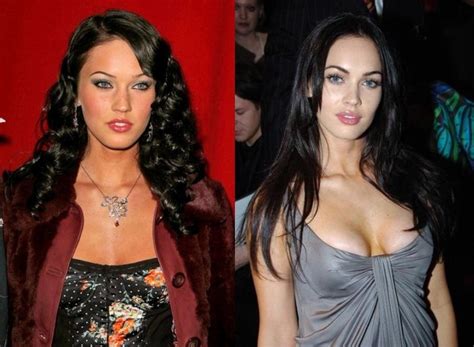 Before and after photos of megan fox's alleged plastic surgeries on her nose and breasts, lip injections, cheek filler,etc. Megan Fox Plastic Surgery Before and After Botox Injection ...