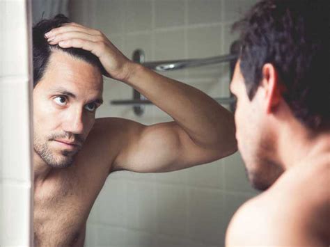 Alopecia areata is a health condition that causes hair loss. Receding Hairline: Stages, Causes, and Treatments