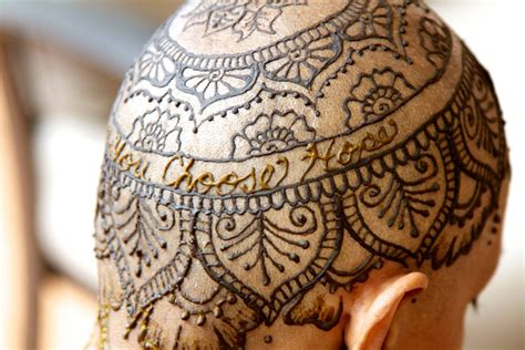 Tattoo dyes — especially red, green, yellow and blue dyes — can cause allergic skin reactions, such as an itchy rash at the tattoo site. Elegant Henna Tattoo Crowns Help Cancer Patients Cope With ...