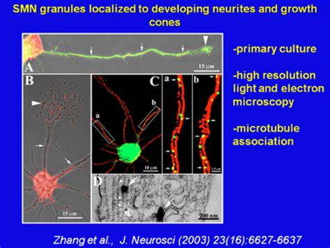 Smn1 is the telomeric copy of the gene encoding the smn protein; Role of the Survival of Motor Neuron protein (SMN) in the ...