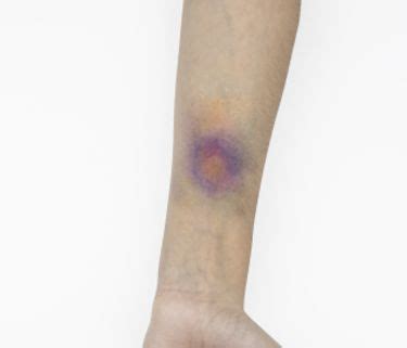 Apply a little makeup to the end of the applicator brush. Fake Bruises - how to articles from wikiHow