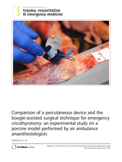 15 editions under this title. (PDF) Comparison of a percutaneous device and the bougie ...