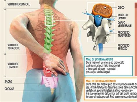 Dolore alla spalla nella parte superiore. Il mal di schiena
