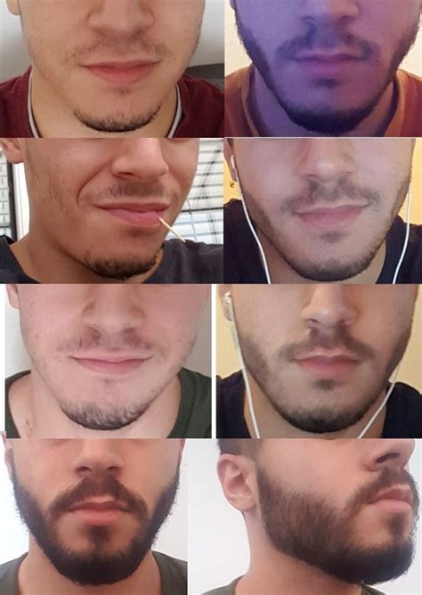 If your teen seems to be anxious about his mustache, or. Increase Facial Hair Growth Men. 3 Ways to Grow Facial ...