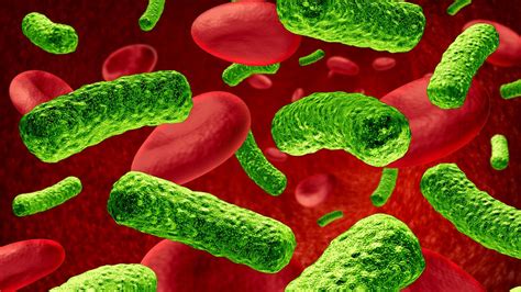What are the signs & symptoms? Blutvergiftung: Sepsis, eine lebensbedrohliche Erkrankung ...
