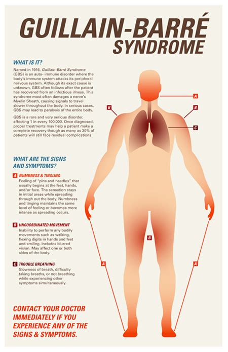 While its cause is not fully understood, the syndrome often follows infection with a virus or bacteria. Neurologistas propõem cartilha para diagnóstico da ...