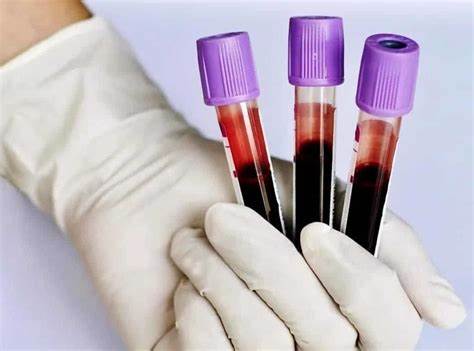 Любимая диета противопоказания Анализ крови на гормоны щитовидной железы: подготовка, как правильно Анализ крови на гормоны щитовидной железы: подготовка, как правильно Любимая диета противопоказания