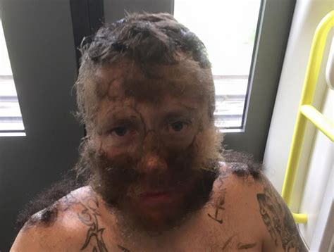 This Man Got His Friends' Pubic Hair All Over His Face - ViralPortal